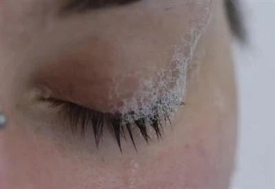 آنکھوں سے صابن کیسے نکالا جائے؟